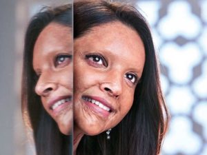 Bollywood Sneak-Peak: Deepika Padukone Shares First Look of ‘Chhapaak’